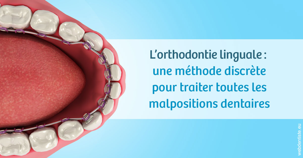 https://dr-hildwein-marc.chirurgiens-dentistes.fr/L'orthodontie linguale 1