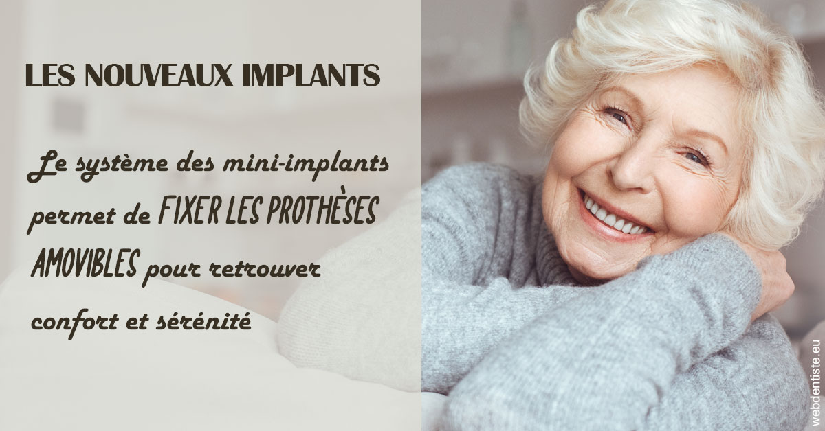 https://dr-hildwein-marc.chirurgiens-dentistes.fr/Les nouveaux implants 1