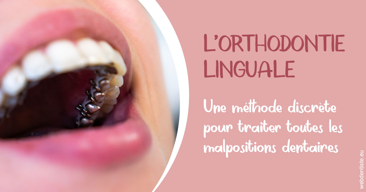 https://dr-hildwein-marc.chirurgiens-dentistes.fr/L'orthodontie linguale 2