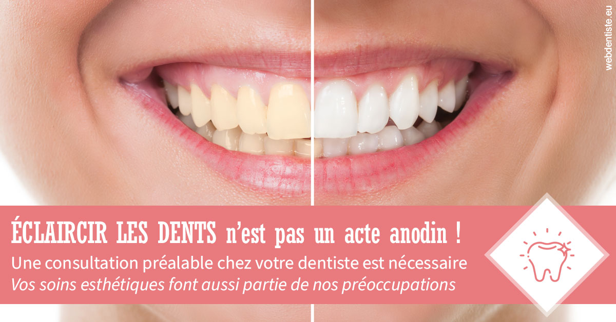 https://dr-hildwein-marc.chirurgiens-dentistes.fr/Eclaircir les dents 1