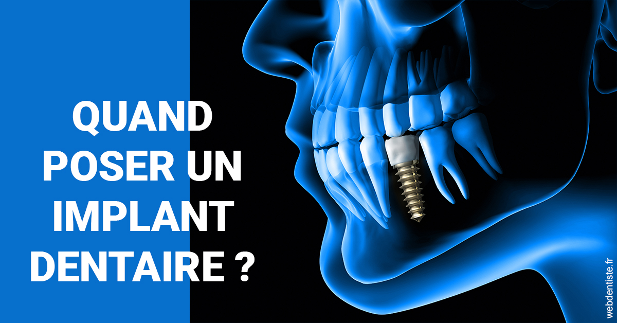 https://dr-hildwein-marc.chirurgiens-dentistes.fr/Les implants 1