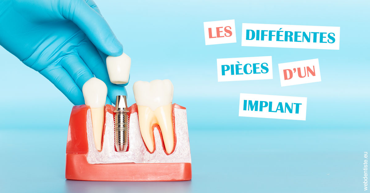 https://dr-hildwein-marc.chirurgiens-dentistes.fr/Les différentes pièces d’un implant 2
