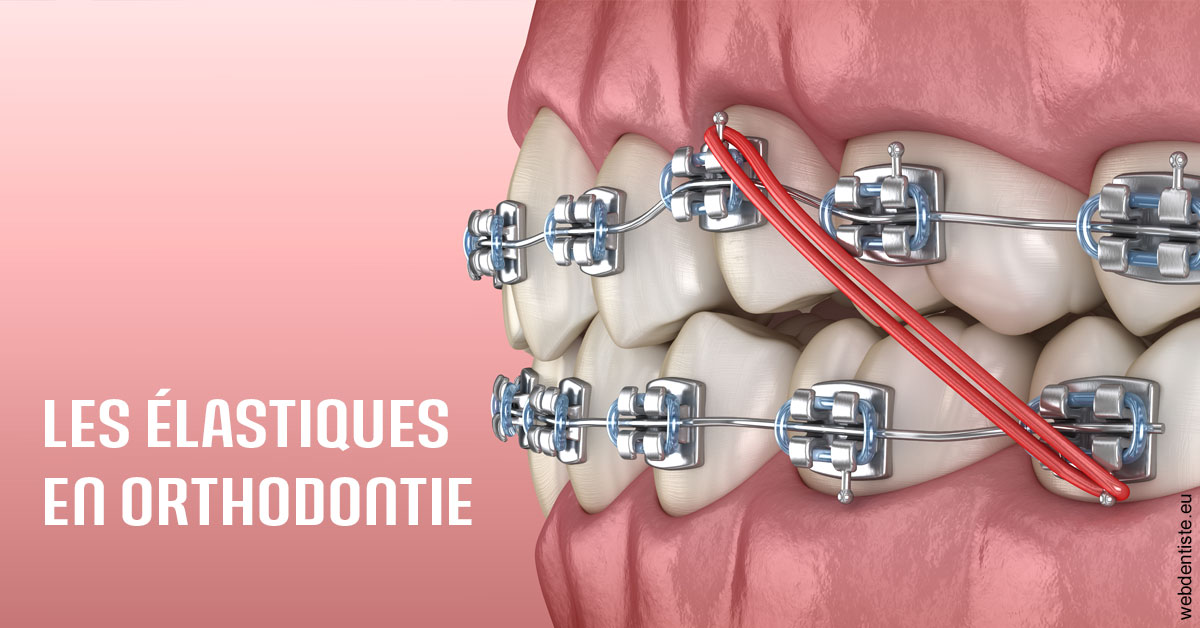 https://dr-hildwein-marc.chirurgiens-dentistes.fr/Elastiques orthodontie 2