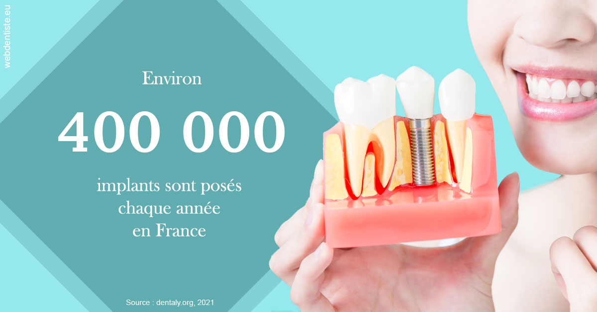 https://dr-hildwein-marc.chirurgiens-dentistes.fr/Pose d'implants en France 2